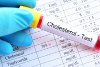 Comprehensive Guide LDL Cholesterol Calculation