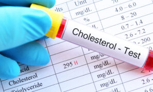 Comprehensive Guide LDL Cholesterol Calculation