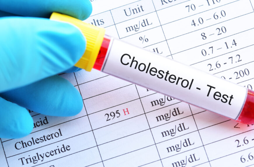 Comprehensive Guide LDL Cholesterol Calculation