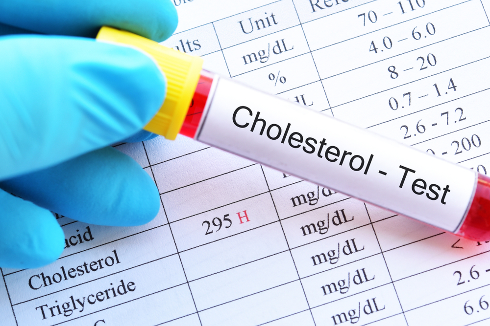 Comprehensive Guide LDL Cholesterol Calculation